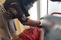 Sadis, Bocah 9 Tahun Warga Pasirian Dibacok Tetangganya