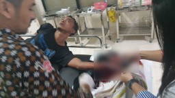 2 Pemuda Bondoyudo dan Klanting Dibacok Tangan Nyaris Putus