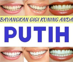 Tips Cara Mudah dan Alami untuk Memutihkan Gigi