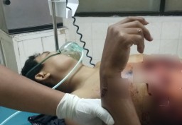 Korban Begal Sadis Warga Jember Sempat Tangkis Sabetan Celurit