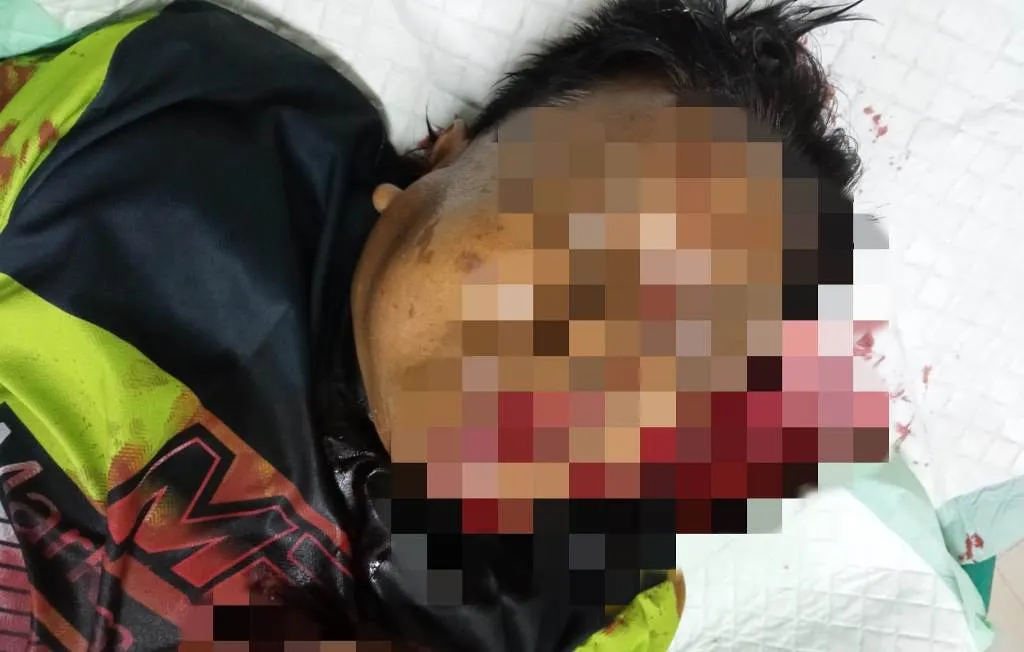 Waduh, Blantik Sapi Asal Bodang Lumajang Dibacok Orang Tak Dikenal