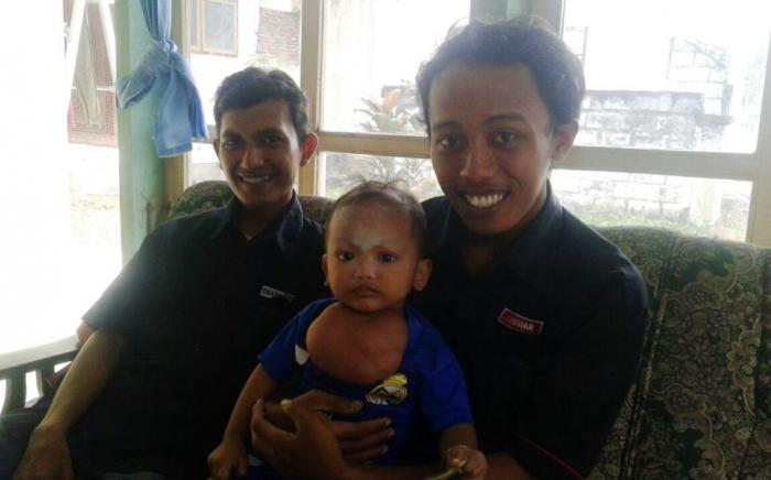 Aqila Kunir Kidul, Bocal 17 Bulan Penderita Tumor Lehar Masih Sehat dan Ceria