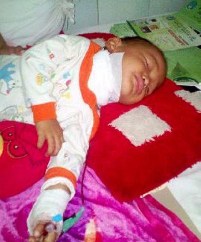 Alhamdulillah...!! Aqila Bocah Pederita Tumor Leher Akhirnya Jalani Operasi di RSSA Malang